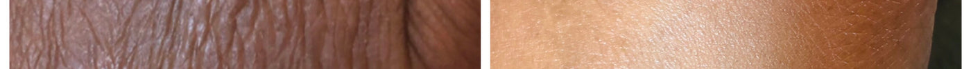 7 Easy Tips on How To Take Care of Winter Dry Skin