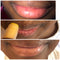 Lip Treat