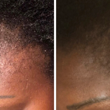 Organic Hair Growth Oil